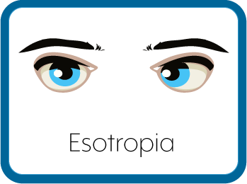Esotropic Eyes Graphic