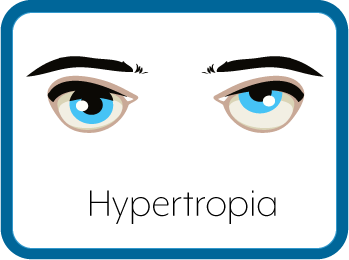 Hypertropic Eyes Graphic