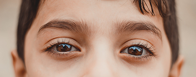 The medical term for lazy eye is Amblyopia. Did you know, in many cases you cannot