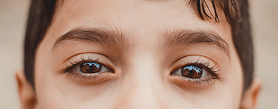 lazy eye, amblyopia, vision, eyes, binocular vision, children