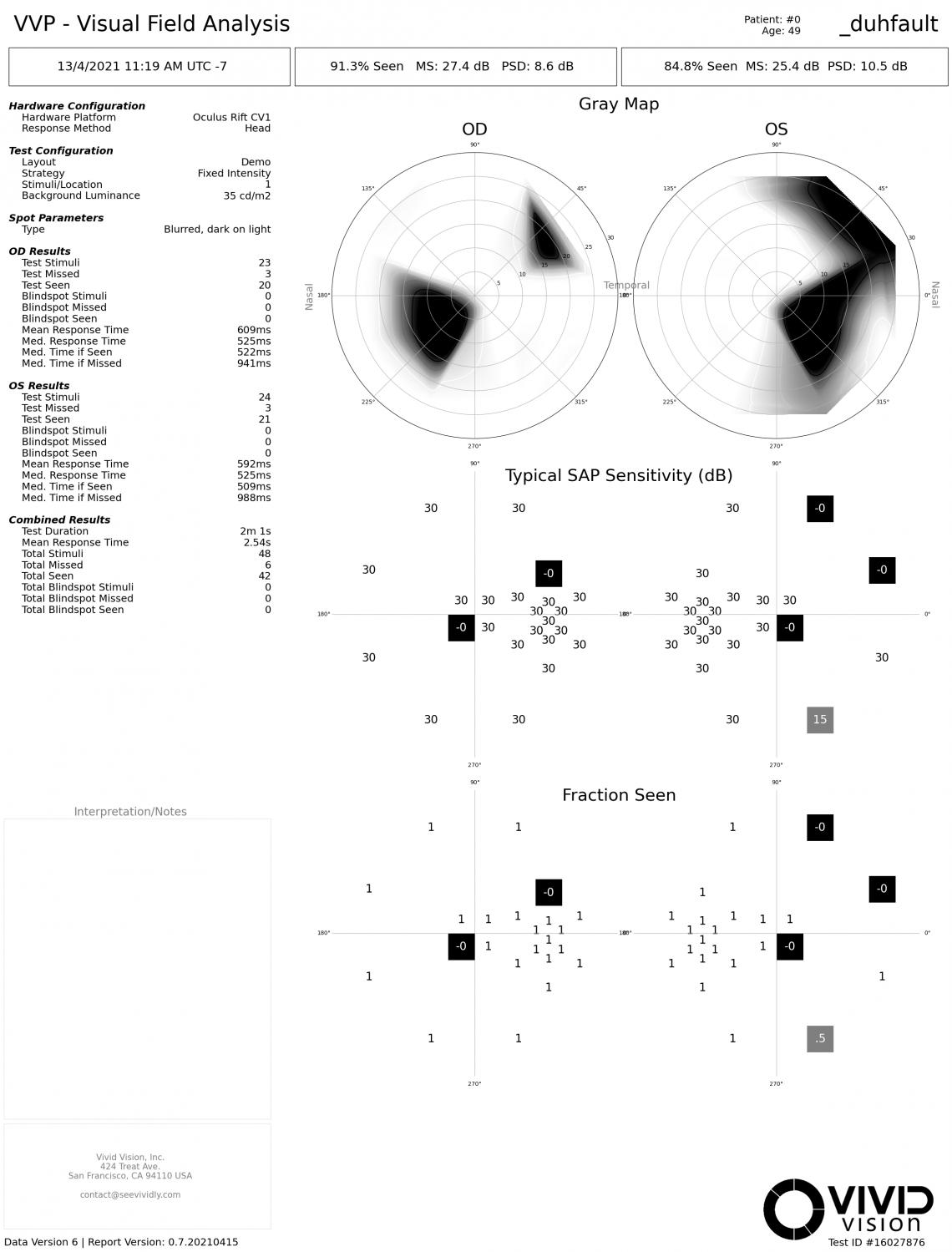 An example report from the Vivid Vision Perimeter.