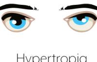Hypertropia Eyes Graphic - hypertropia amblyopia strabismus vergence disorders exotropia divergence excess strabismic refractive esotropia exotropia