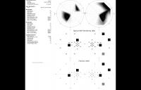 VVP Example Report - vvp visual field data report high resolution